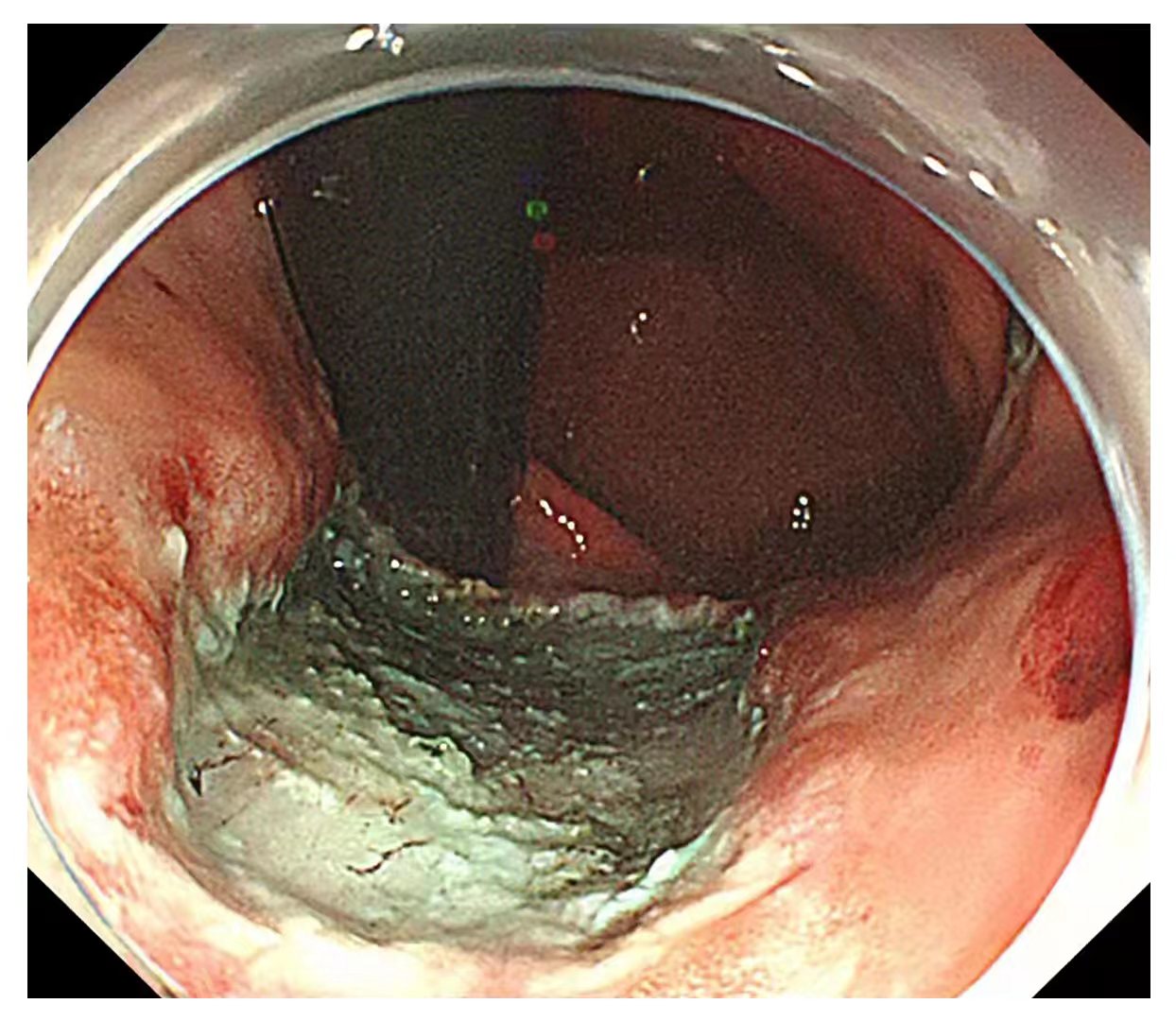 【同德医疗】运城同德医院消化病中心发挥资源优势，完善检查手段，改进就医体验，创新治疗方案，人才队伍雄厚，开展项目齐全。(图7)